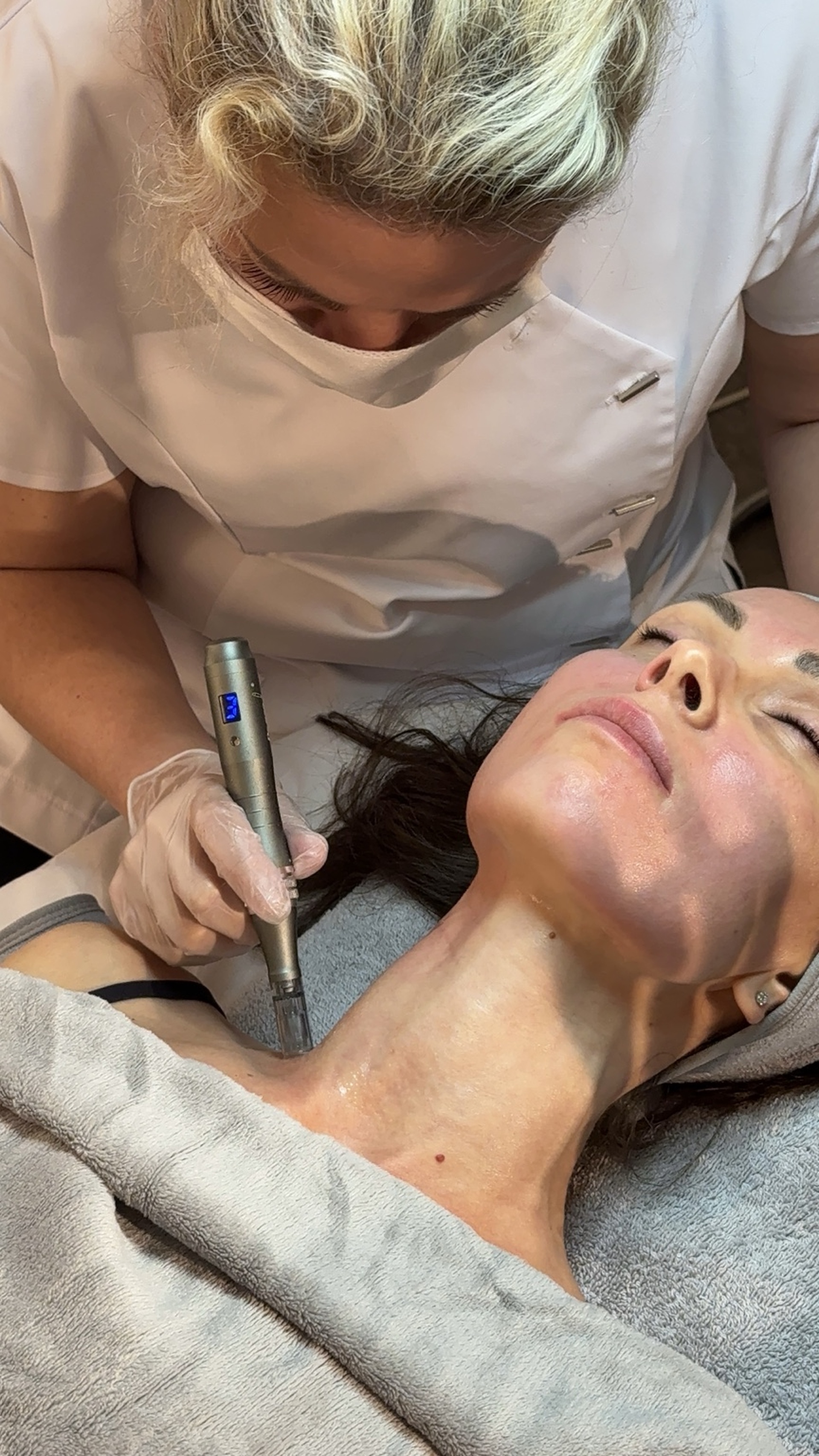 Microneedling Behandlung Hamburg – PORTUPELL Skincare