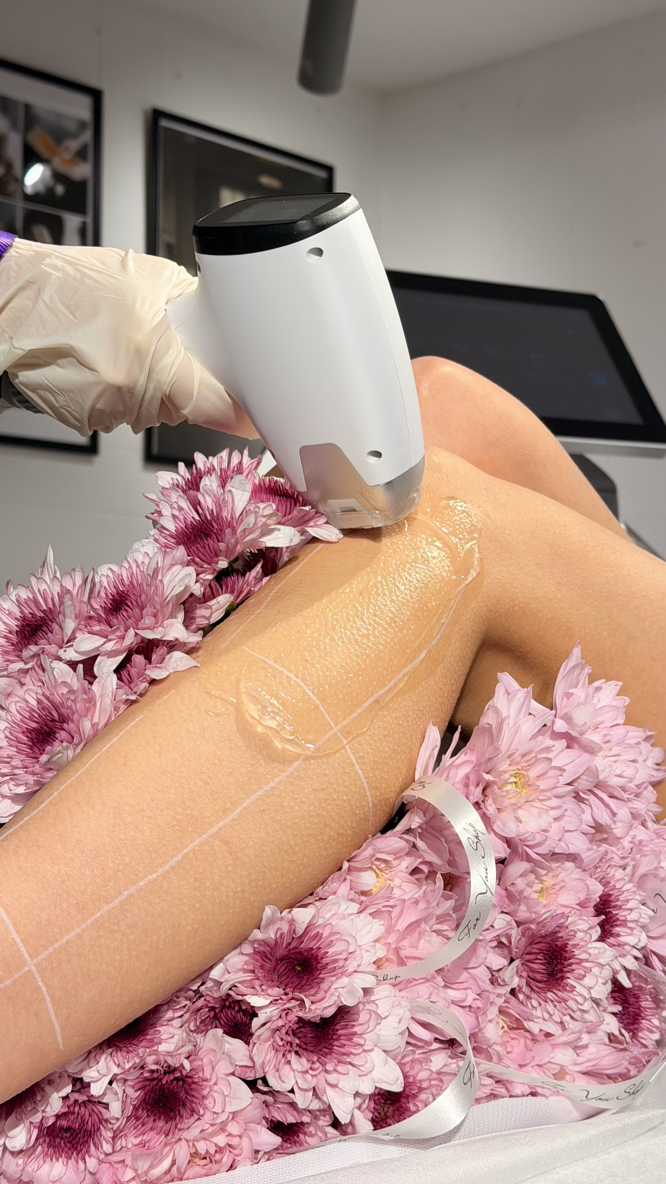 Laser-Behandlung